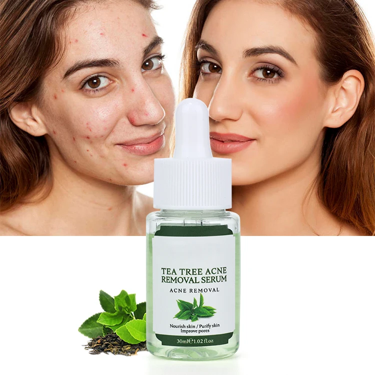 

Private Label Natural Organic Herbal Skin Care Repair Treatment Acne Pimple Remover Blemish Anti Acne Face Tea Tree Serum
