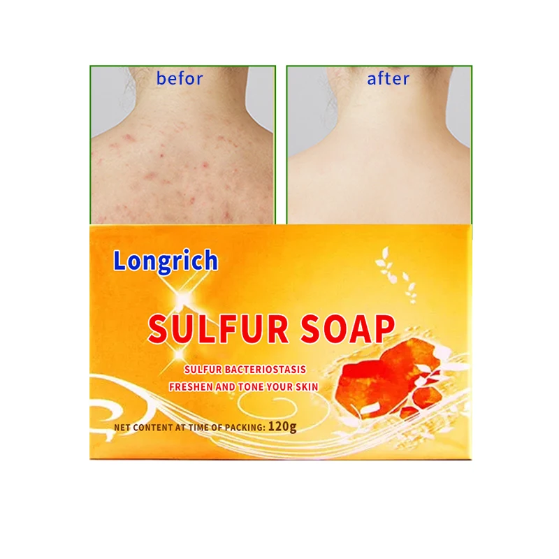 

Longrich Anti bactarie sulfur soap body wash summer degreasing bath acne face bar natural soap face soap bar, Green