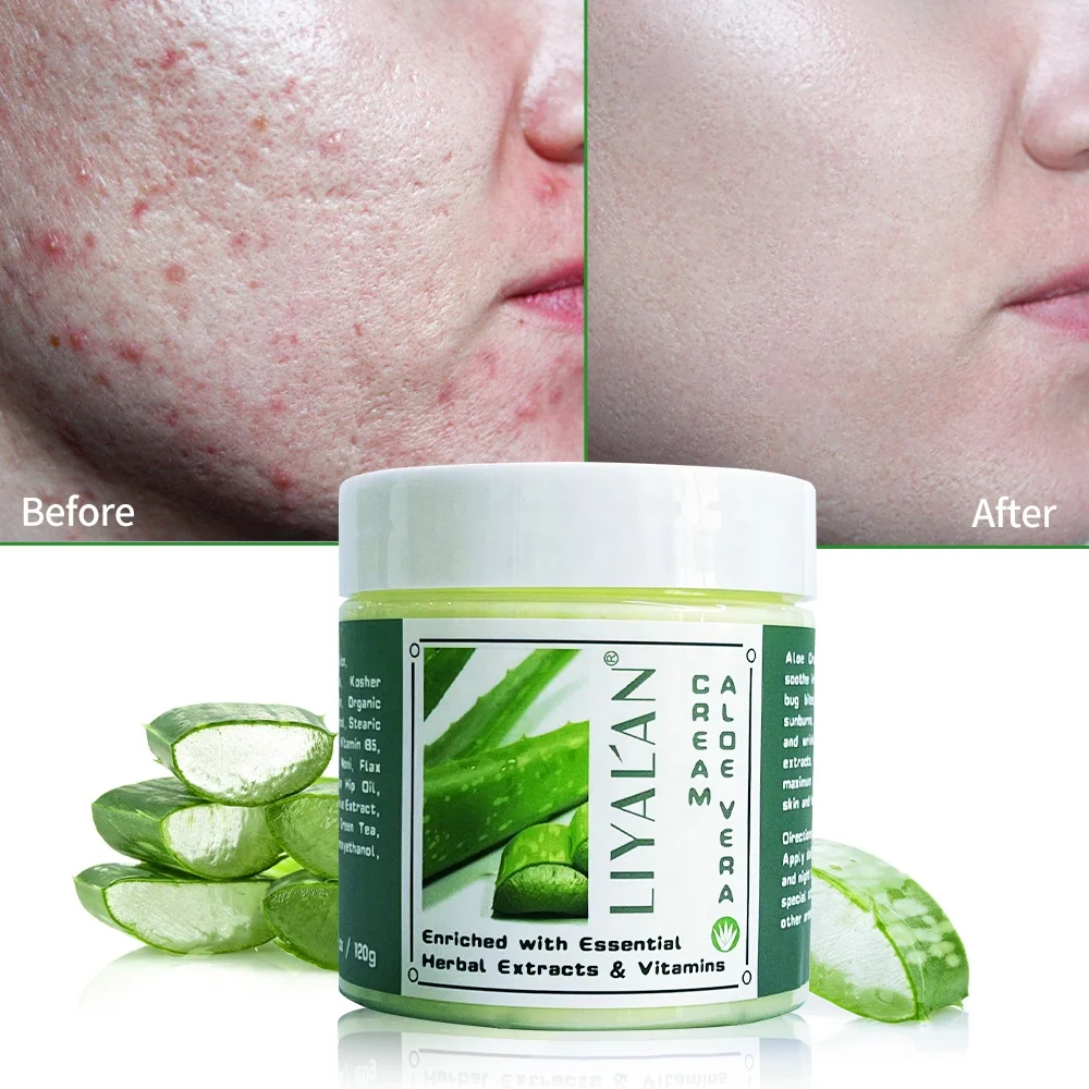 

Custom Vegan 100% Face Care Pure Organic Pimples Dark Spot Remover Cream Moisture Aloe Vera Face Cream