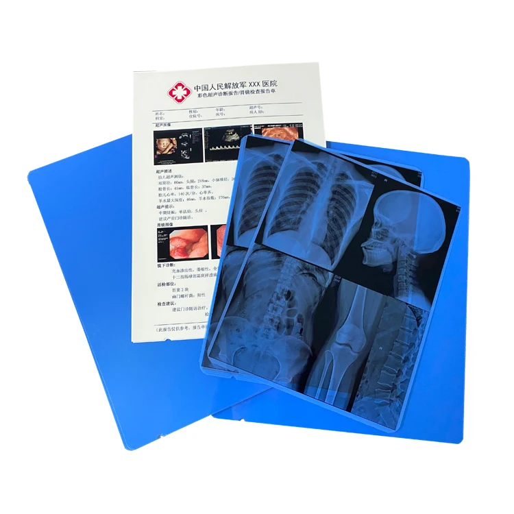 
A4 PET Based Dry Ultrasound White Medical Film for Inkjet Printing 