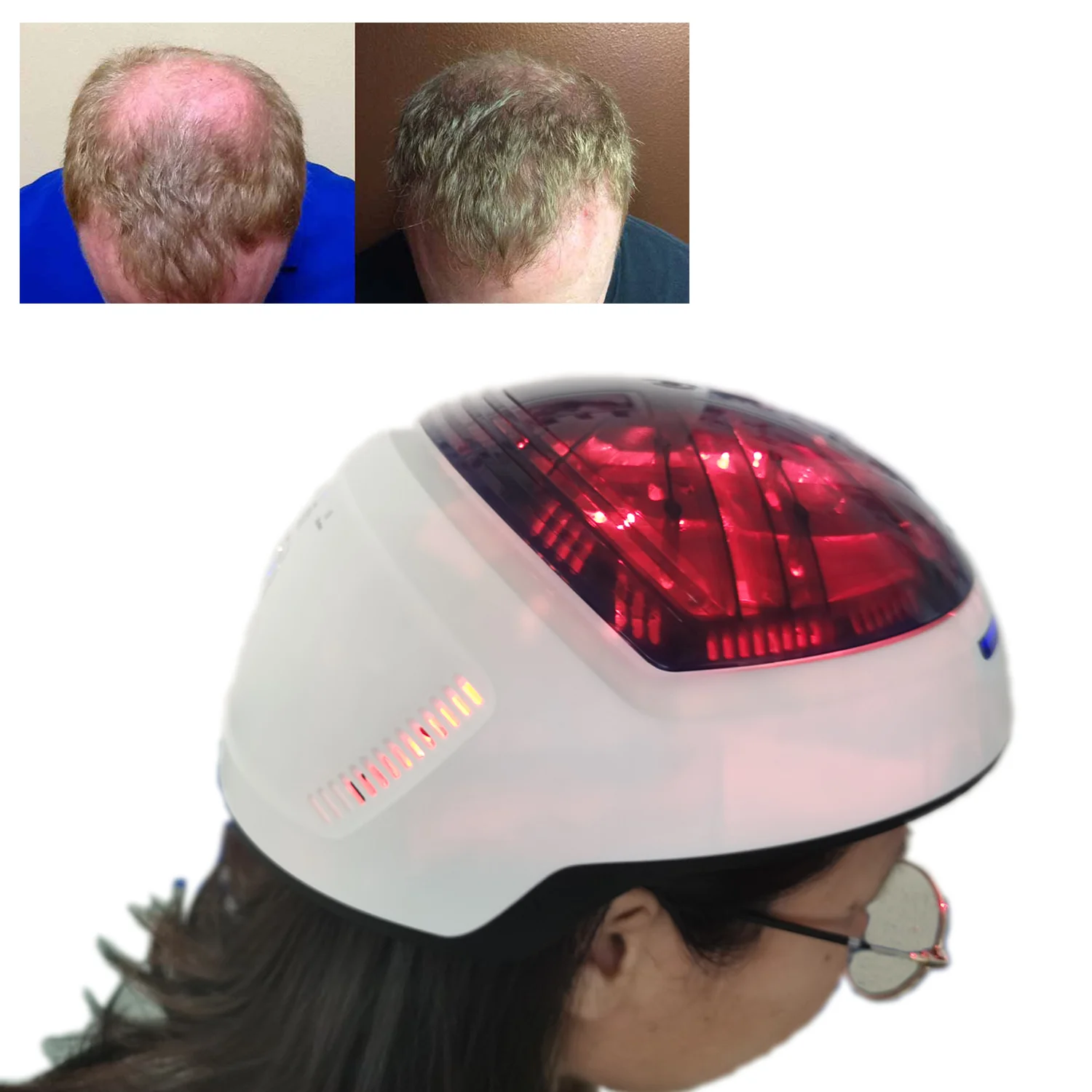 

laser helmet phototherapy pdt led machine/ anti hair loss treatment, Blue, green, purple, orange