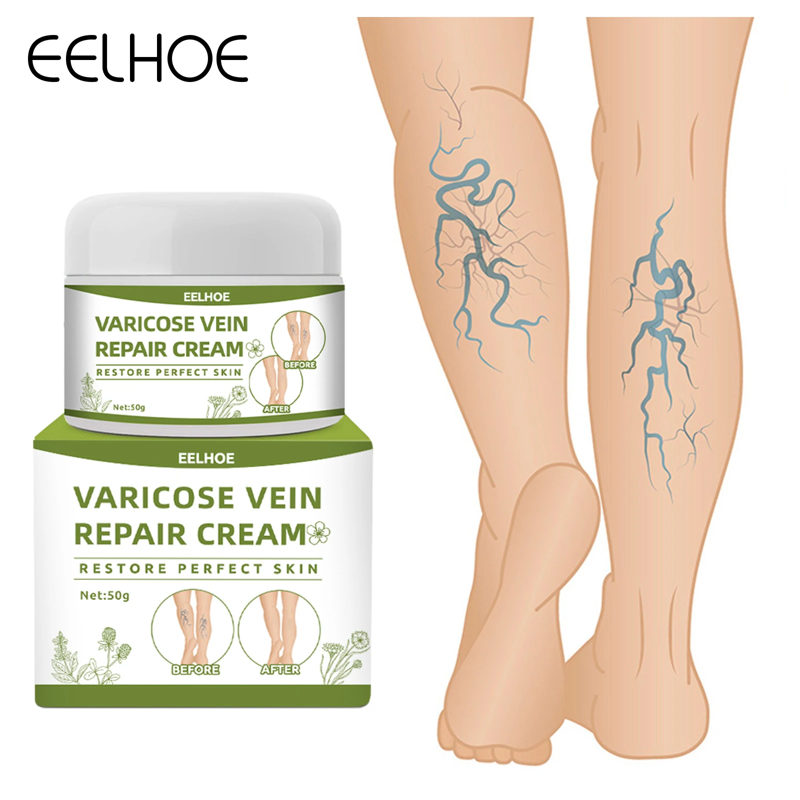 

eelhoe Varicose Veins Relief Cream Vasculitis Phlebitis Spider Pain Relief Ointment Medical Plaster Body Care 50g