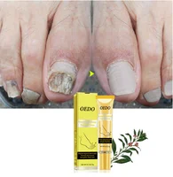 

OEDO Ginseng Nail Treatments Cream Remove Onychomycosis Fungus Paronychia Promote Nail Growth Foot Cream Nail Care