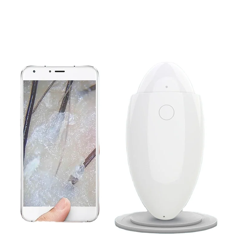 

Wireless Hair Analyzer/ Scalp Problem Checker, White