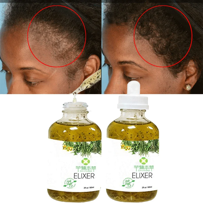 

Private Label 100% Natural Organic Nourishing Scalp Man Women Loss Treatment Hair Growth Oil Serum