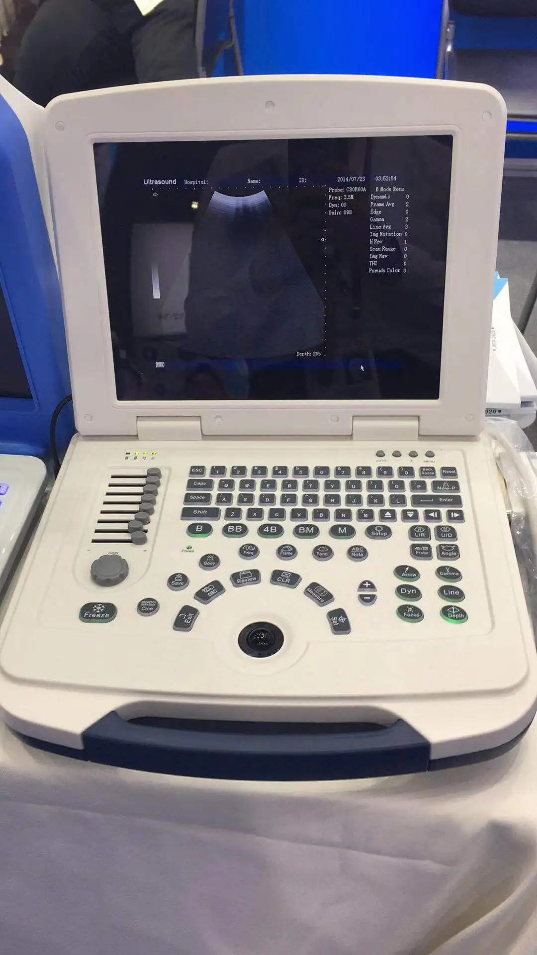 Notebook Digital Diagnostic Ultrasound Scanner System Machine with Battery
