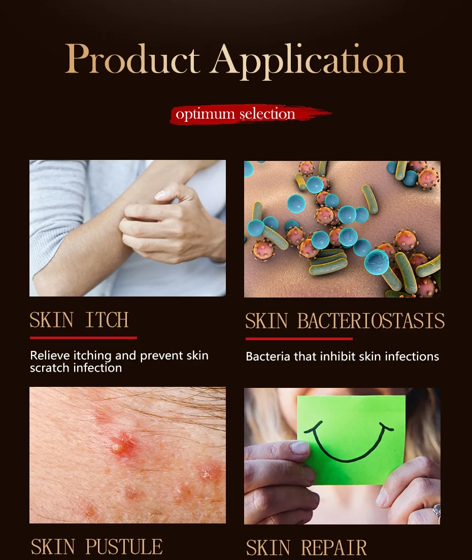 100 Natural Herbal Cream For Allergies Dermatitis Eczema Pruritus Psoriasis Ointment Skin