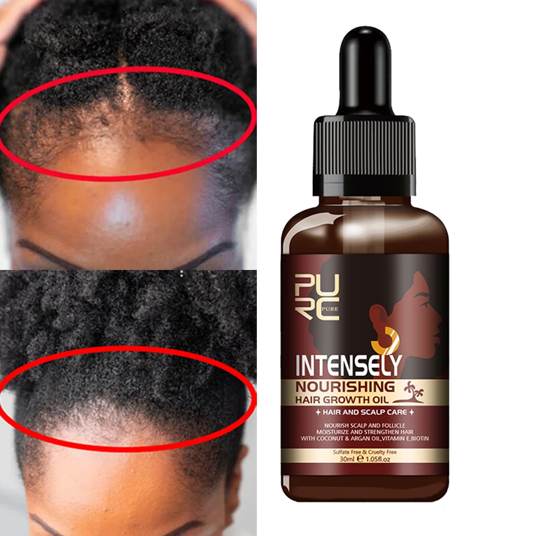 

Private Label Natural Biotin Vitamin hair growth oil reduce hair loss nourish scalp and hair growth serum