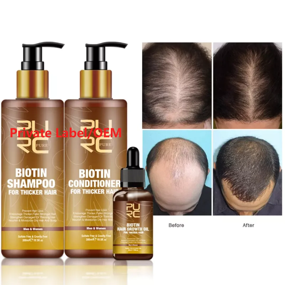 Private Label Natural Organic Anti Hair Loss Hemp Argan Oil Biotin Mild Hair  Growth Shampoo For Men Women Sensitive Scalp - Buy Biotin Hair Growth  Shampoo,Hair Shampoo,Shampoo Product on 