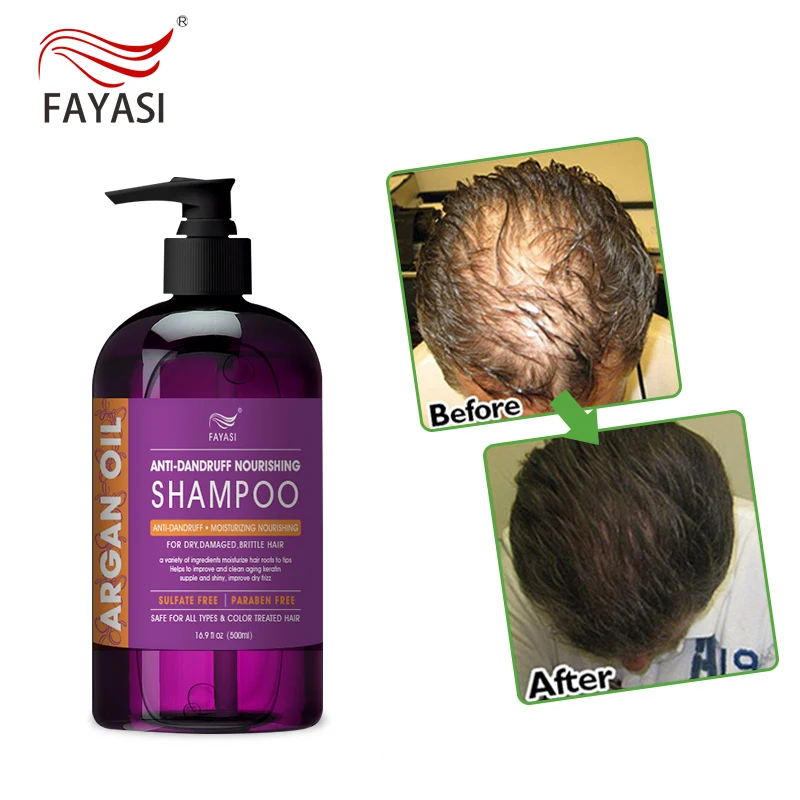 

Wholesale low moq argan oil morocco shampoo and conditioner argan oil hair shampoo