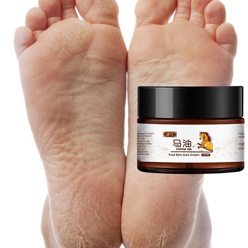 

foot cream diabetes foot cream dead skin foot cream deodorant