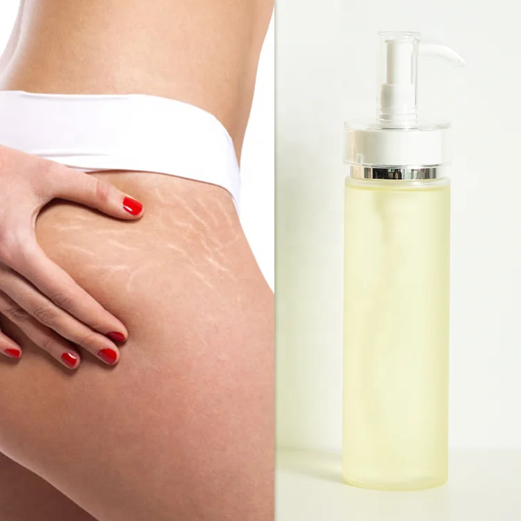 

privated label repairing moisturizing stretch mark removal oil treatment for stretch marks anti body stretch marks