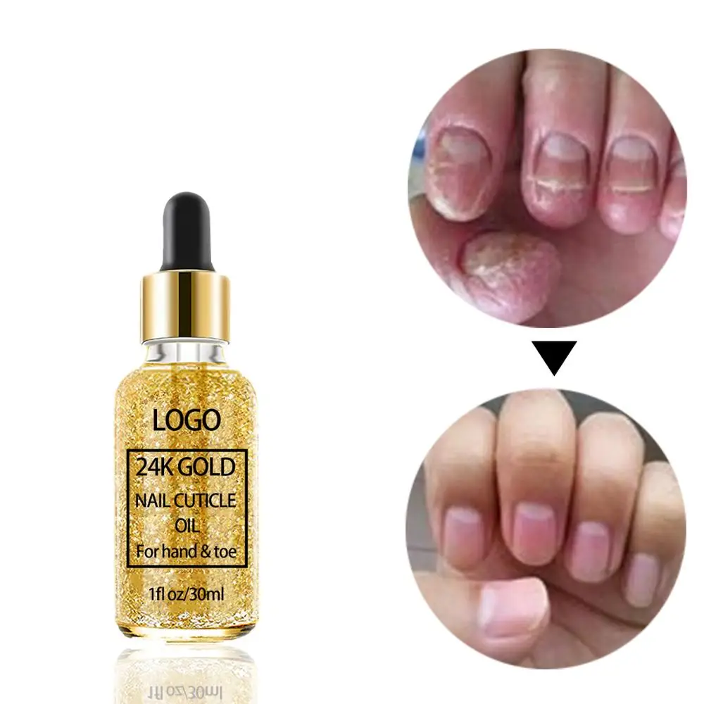 

Custom Label Logo OEM Revitalizer Nourishing Repair Toe And Nail Treatment Natural 24K Gold Cuticle Oil, Gold or custom
