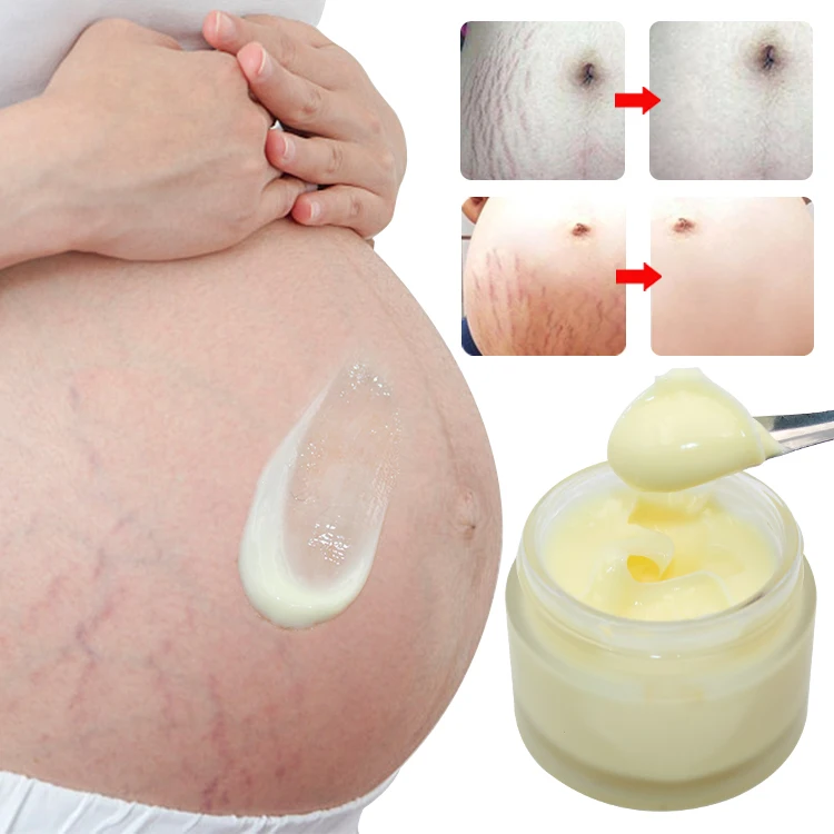 

new arrival vitamin c retinol hyluronic acid repair cream private label fat people scar remover stretch mark cream