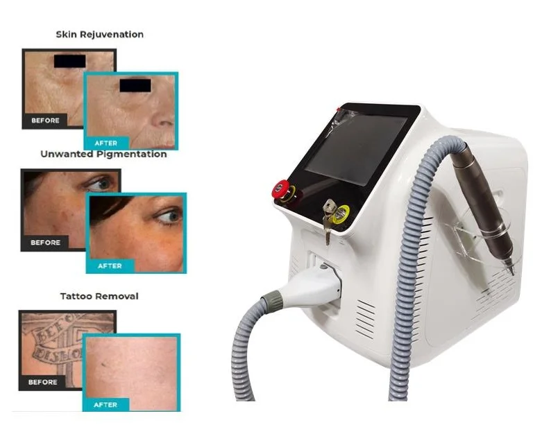 

Best Beauty Salon Use Tattoo Removal Machine 1064nm 532nm Picosecond Laser