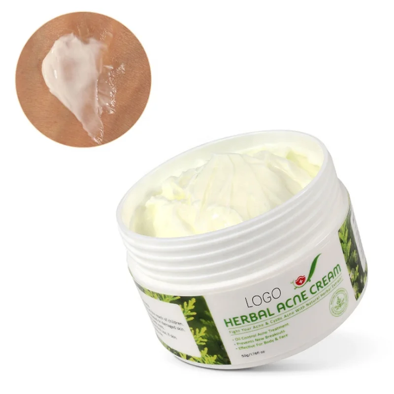 

Organic Herbal Extract Anti Acne Treatment Face Cream Remove Pimple Moisturizing Whitening Skin Care Facial Cream