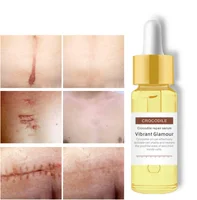 

Crocodile Repair Scar face serum Removal Acne Scar Whitening for Spots Acne Treatment Stretch Marks Skin Care
