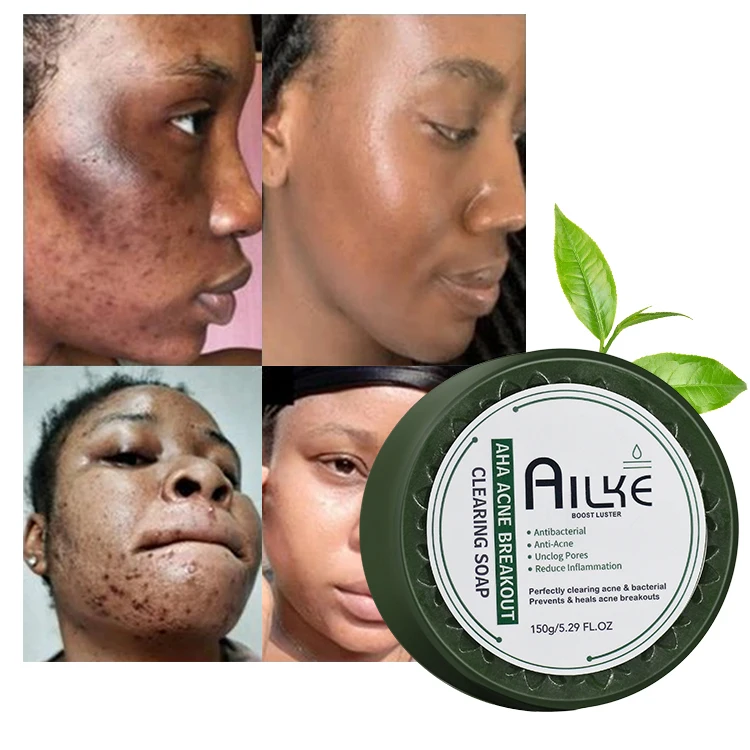 

ailke manufacturing 100% organic AHA handmade soaps facial bar acne removal whitening soap from dubai