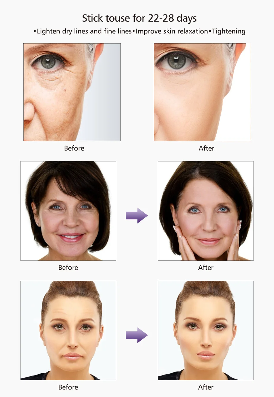 balala series omy lady face lifting anti aging a