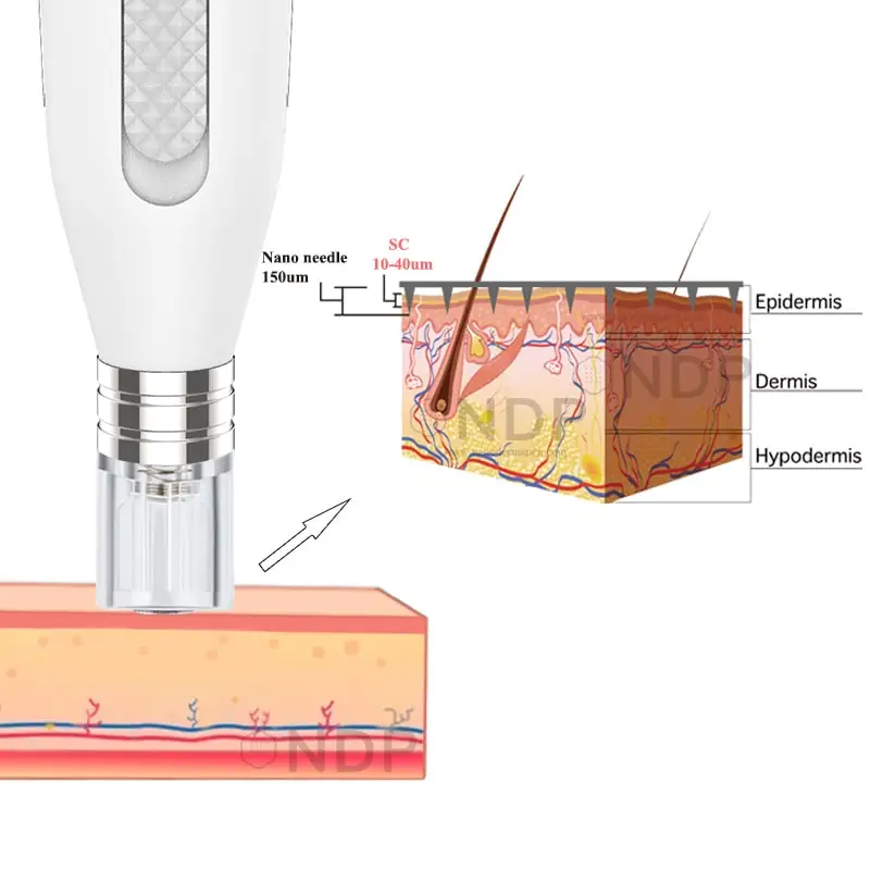 
OEM Agulha Nano Aiguille Needling DermaPen Skin Infusion Machine Needle Mesotherapy Professional 3D Silicone Chip Nano Derma Pen 