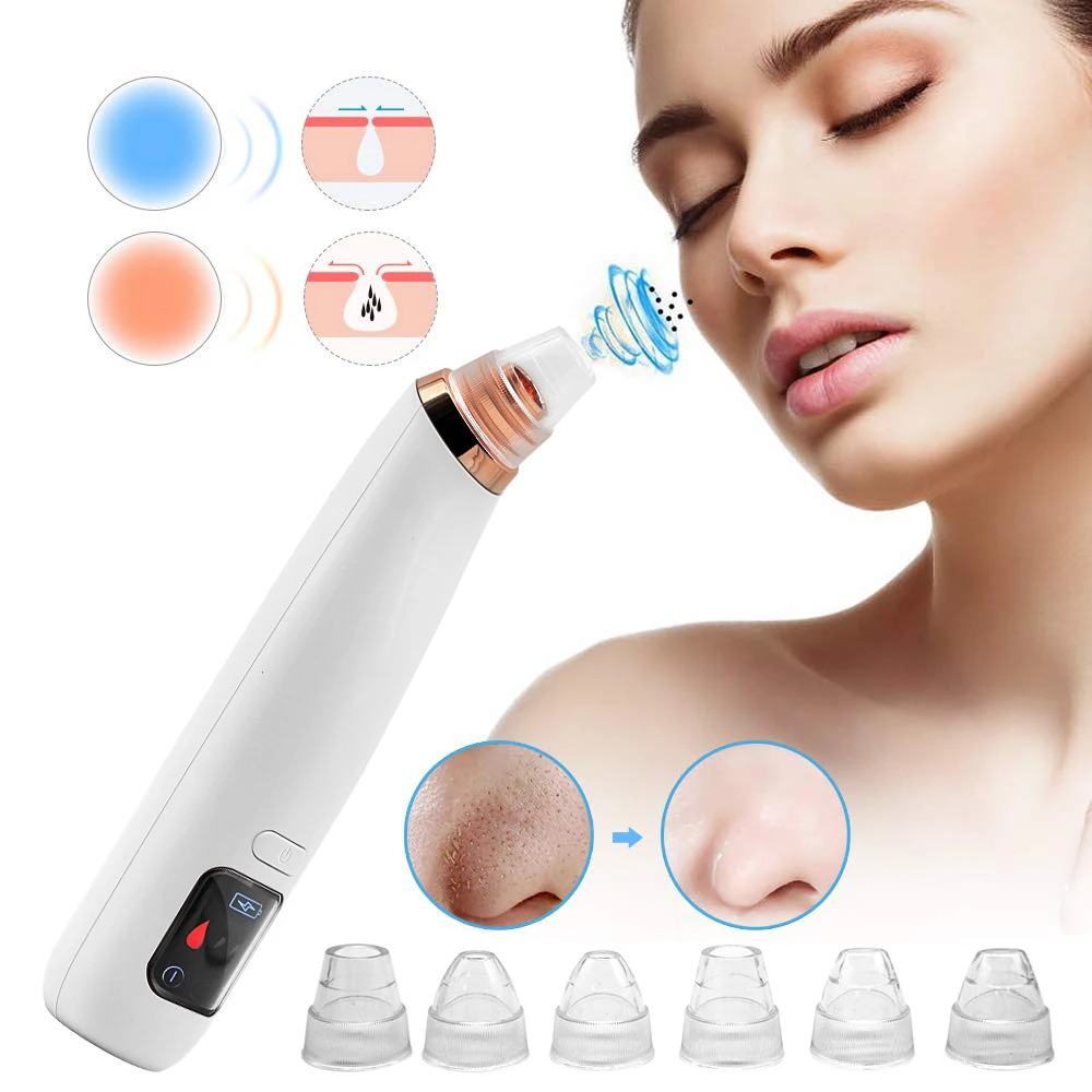 

rechargeable electric black head nose facial pore cleanser kit vacuum blackhead remover with heating, White