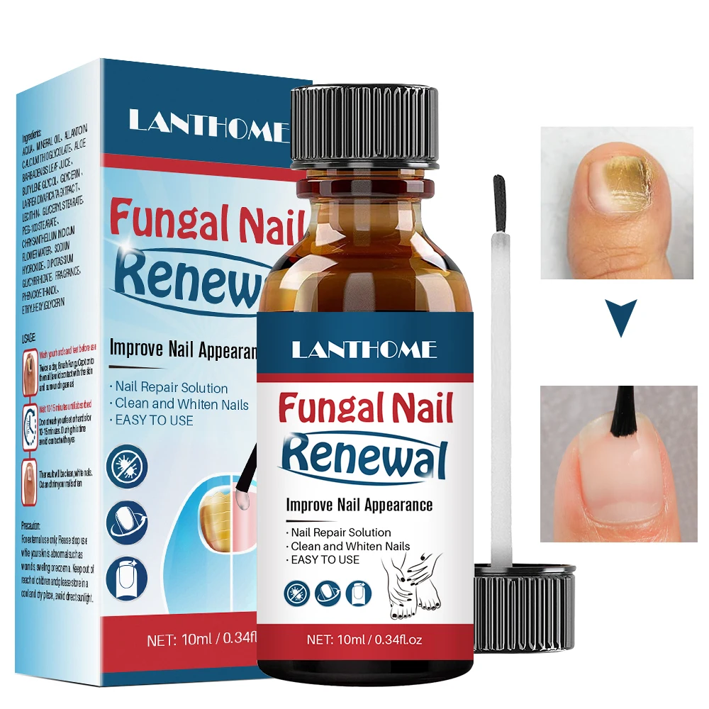 

LANTHOME 10ml nail repair solution clean whiten nourish nails fungal nail treatment toenail fungus treatment