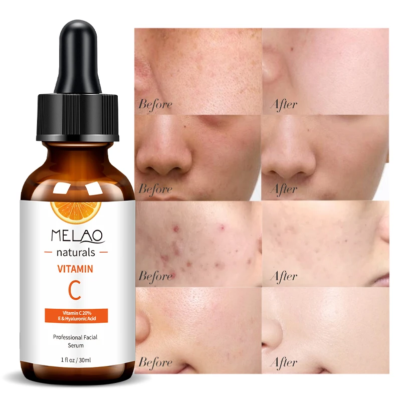 

Best-selling MELAO private label skin care 100% ordinary anti wrinkle face Vitamin C Serum