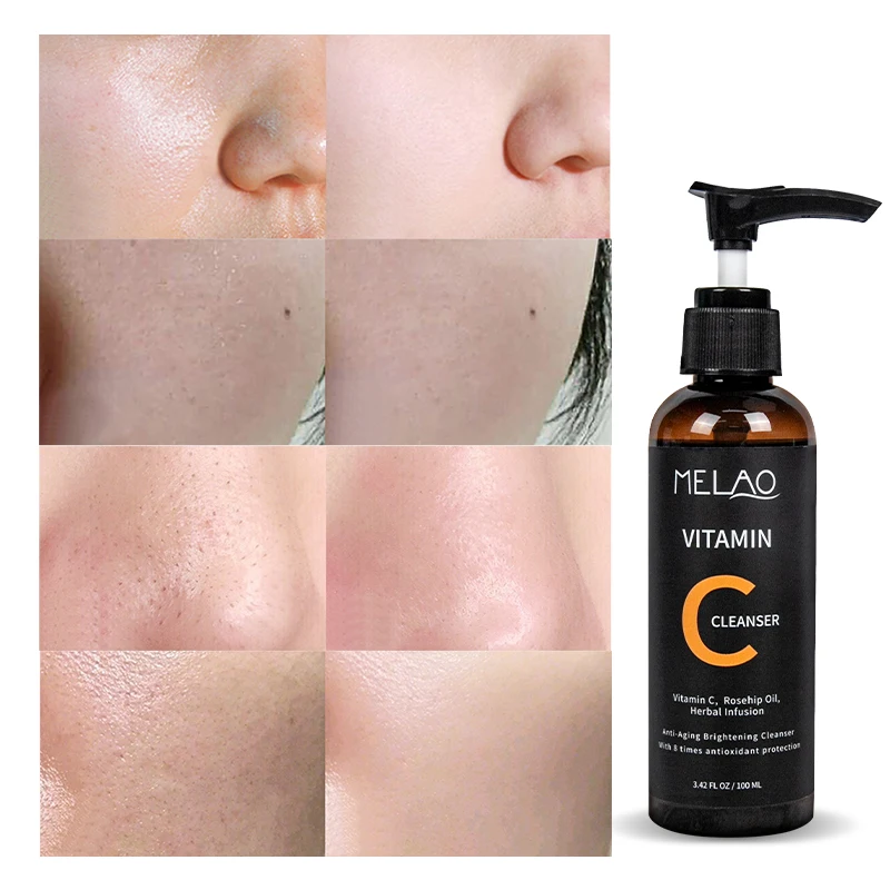 

OEM Private Label Gentle Facial Deep Cleansing Anti Acne Aging Brightening Whitening Vitamin C Cleanser Face Wash