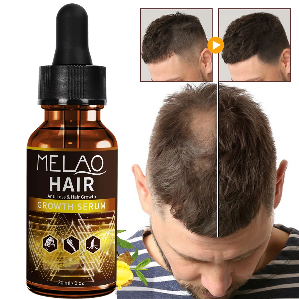 

Private Label Natural Bulk Organic Vegan Hair Treatment Serum Wholesale Custom Herbal Anti Hair Loss Boosting Hair Growth Oil