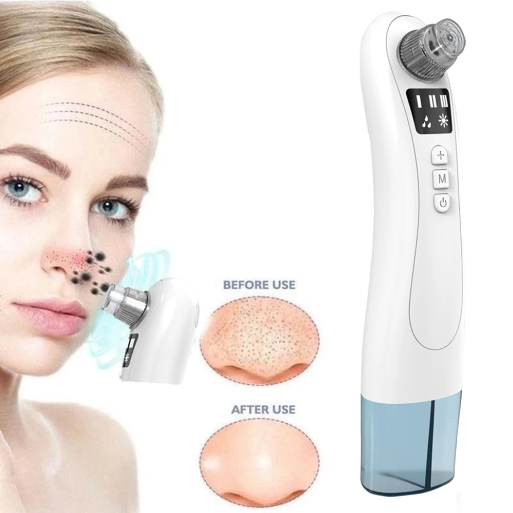 

Best seller beauty face electric vaccum pore cleaner spatula blackhead remover extractor machine