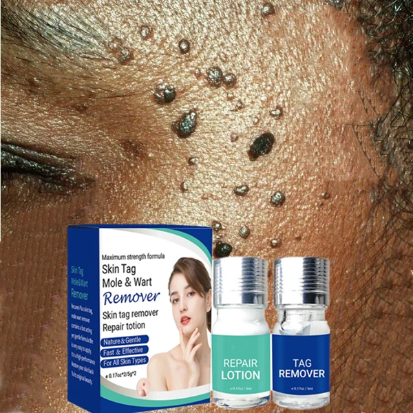 

Fast delivery Private Label 2 in 1 skin tag removal kit warts removal cream wart & tags mole remover cream with No Pain