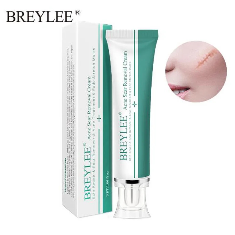 

2020 Breylee Best Herbal Face Whitening Moisturizing Acne Treatment Scar Pimple Removal face Cream