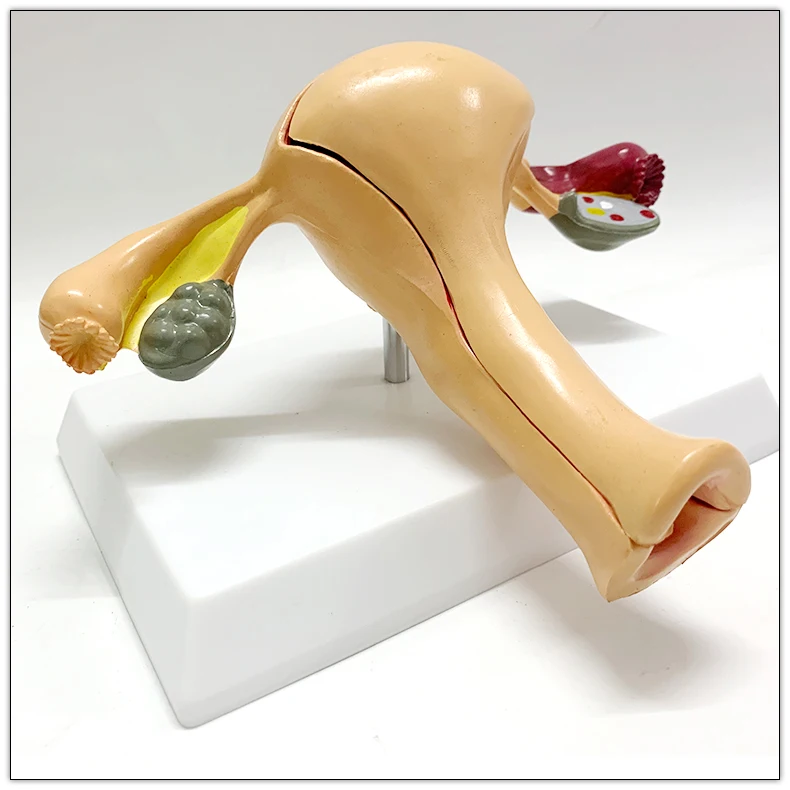 Life Size Medical Women 's Internal Reproductive Anatomy Model Uterine ...