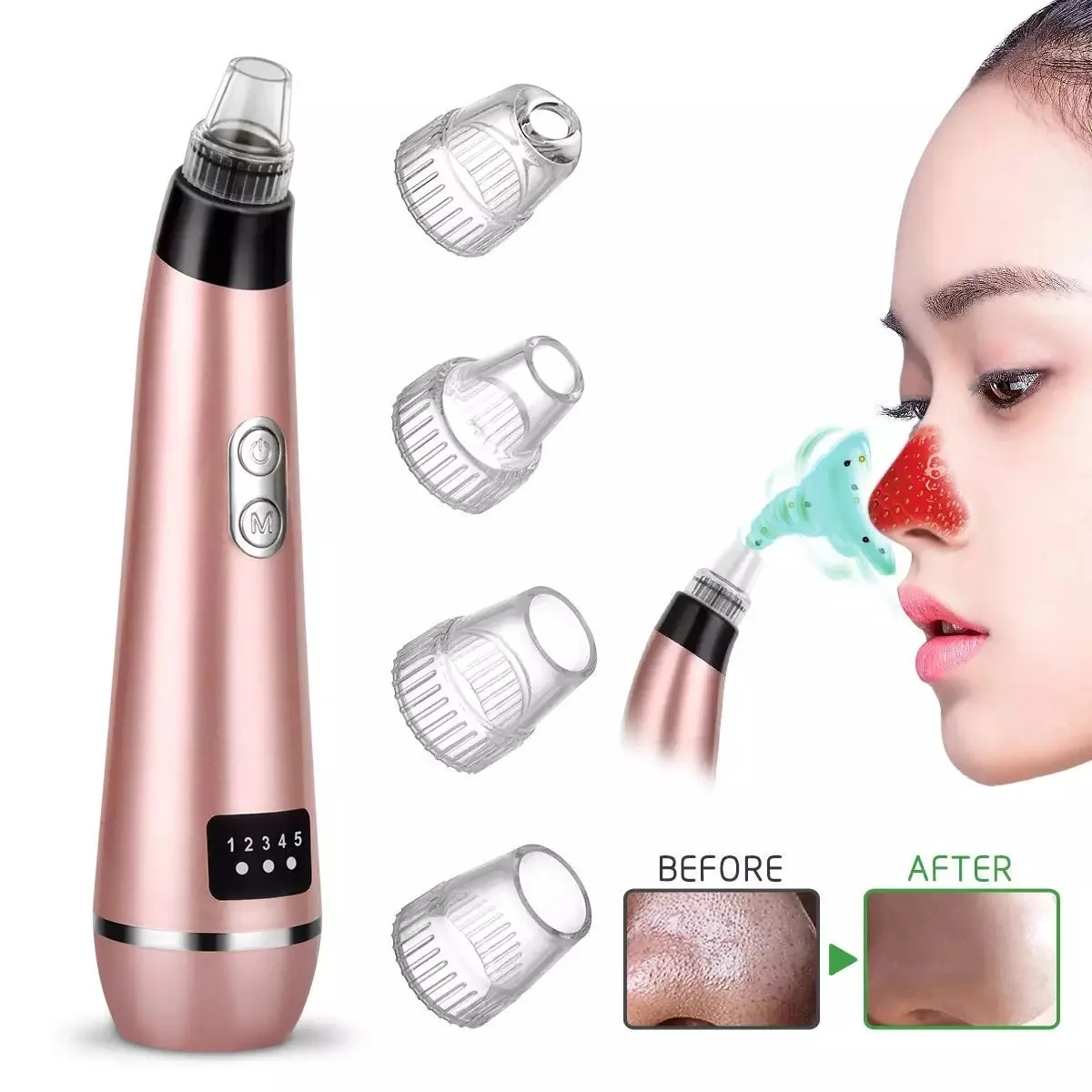 

japan face clean vacuum suction blackhead comedone acne pimple blemish extractor vacuum pore cleaner whitehead remover tool kit