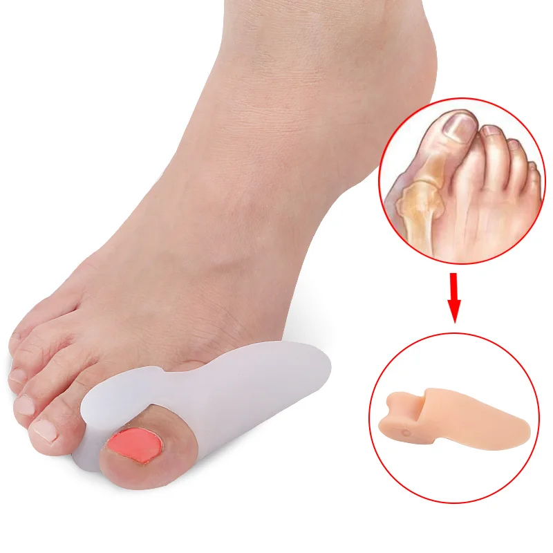 

Silicone Bunion Corrector and Bunion Relief Gel Toe Separator Guard Big Toe Spreader Cushion Bunion Pads, White,skin