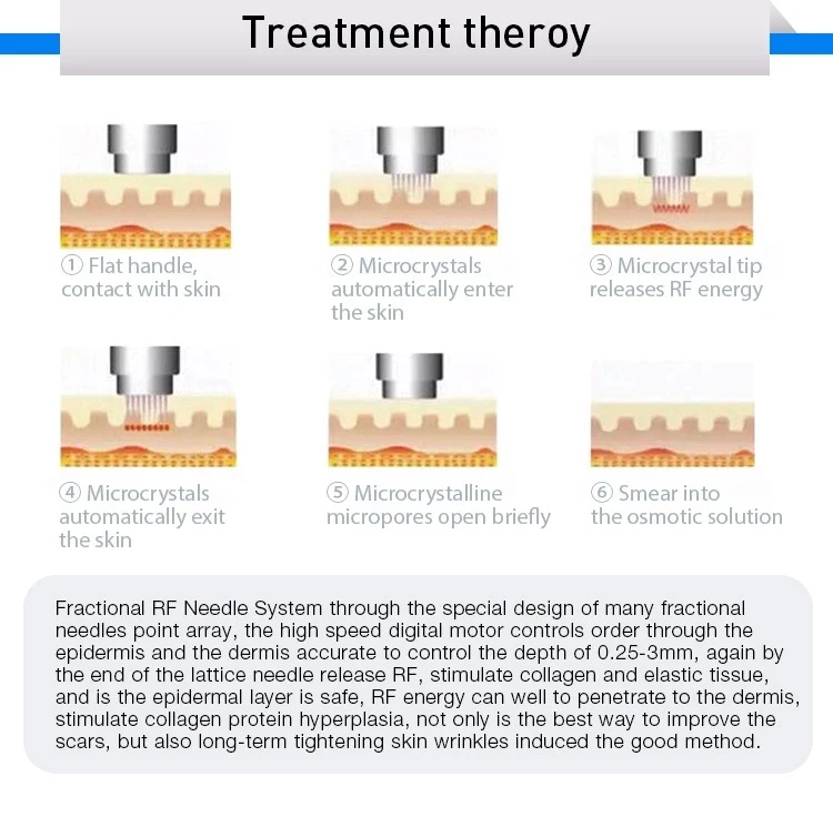 New Edition Microneedle Rf Machine Facial Lifting Beauty Instrument Skin Rejuvenation Machine for Spa and Clinic Use