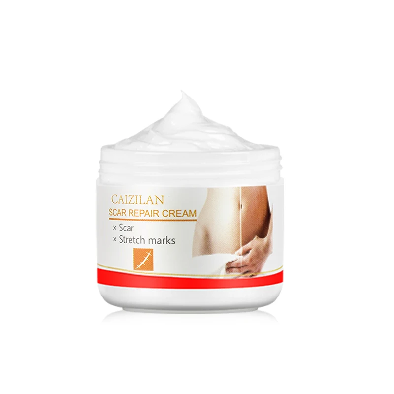 

CAIZILAN Scar Removal Cream Pregnant Women Pigment Correction Repair Body Gel Firming and Brightening Stretch Marks