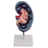 BIX-A1079 human anatomy medical science simukation kidney training model