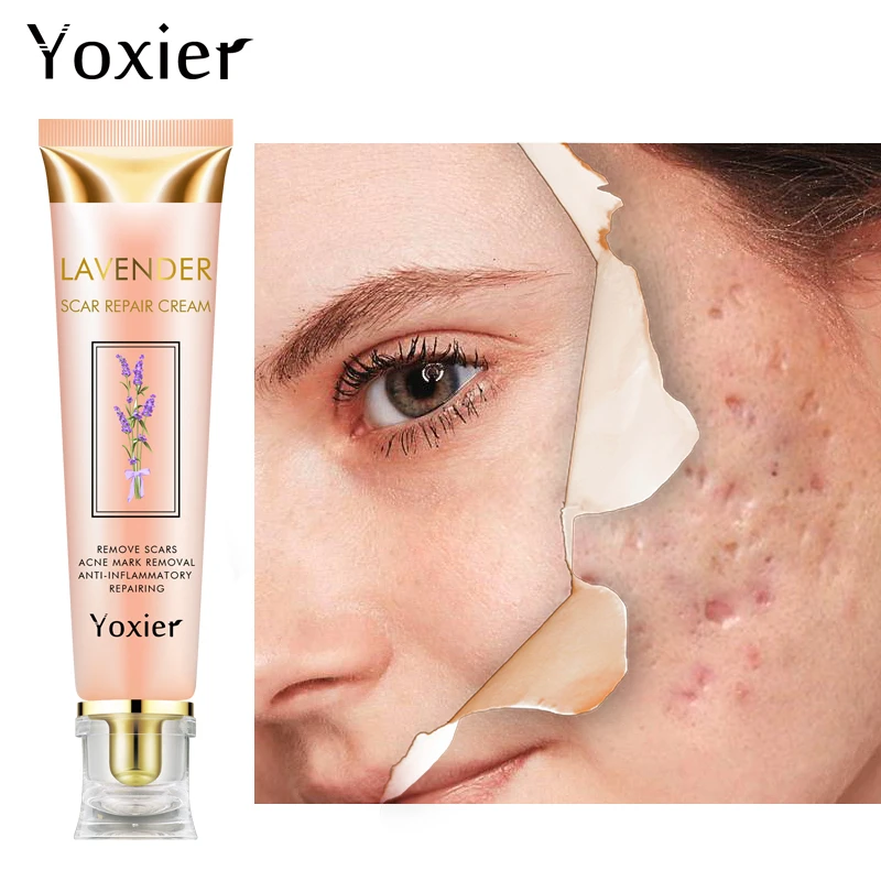 

Yoxier Scar Removal Treatment Acne Face and stretch mark removal cream