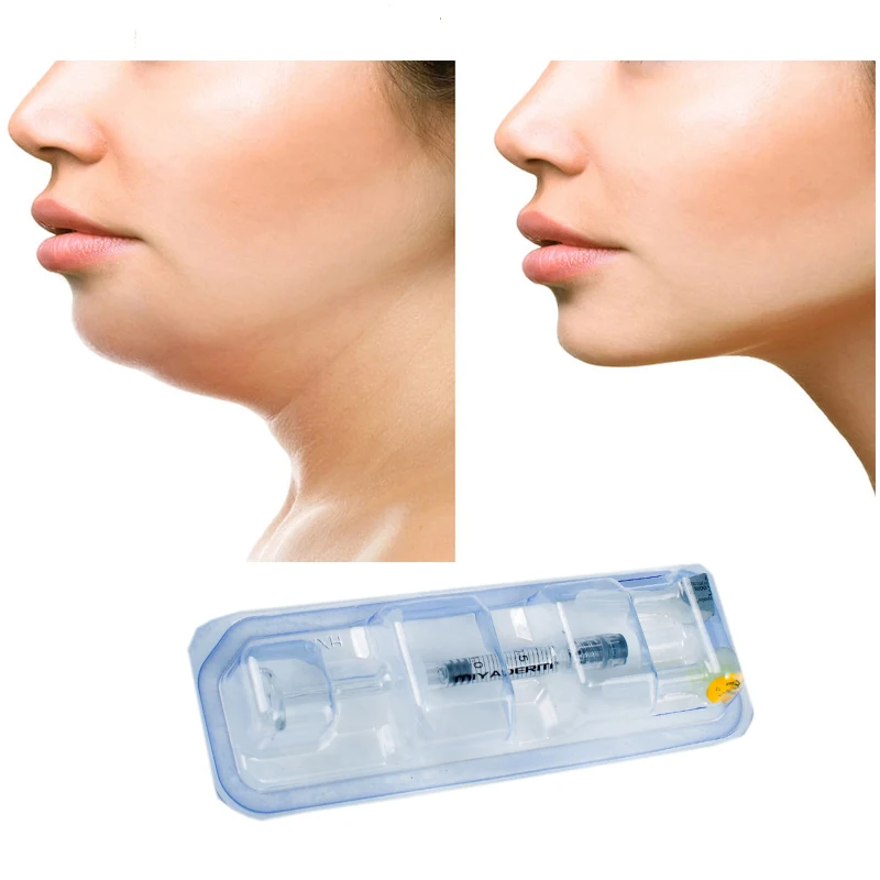 

Shaping face contour dermal filler best hyaluronic acid