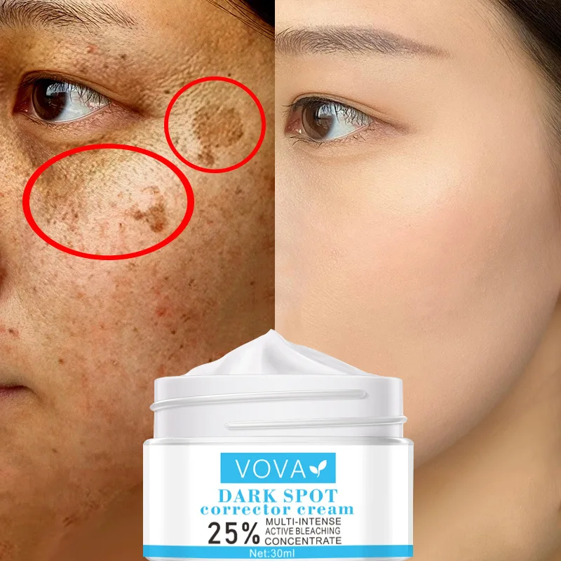 

Pravite Label Remove Melasma Whitening Black Spot Skin Care Cream