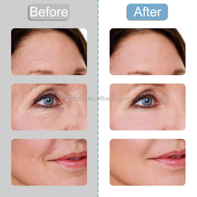 Face Wrinkle Patch (7).jpg