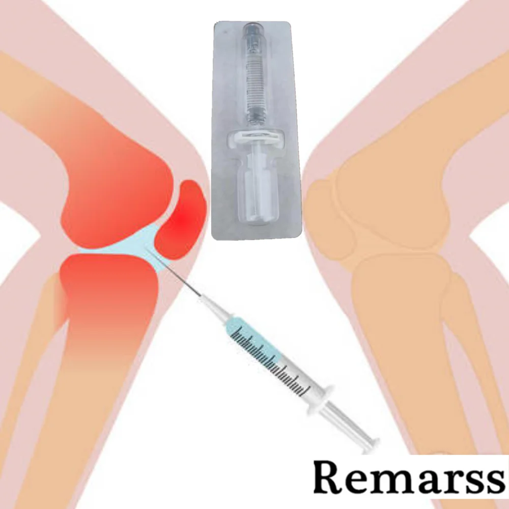 Гиалуроновая в сустав. Укол в коленный сустав гиалуроновой. Уколы в колено для суставов гиалуроновая кислота.