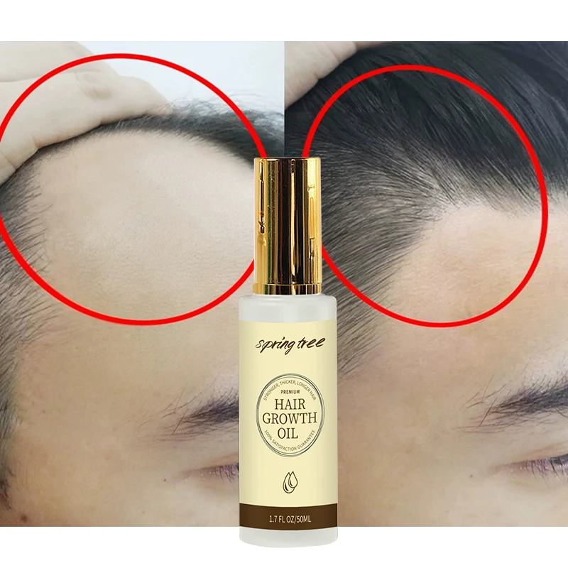 

Private label Hair Growth organic Serum for men and women Improve Hair Loss Balding Nourish Scalp