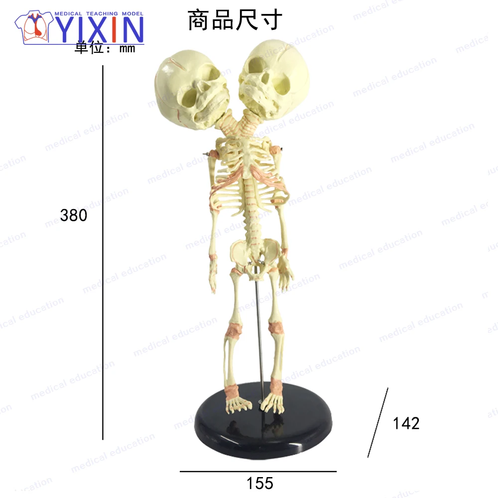 RUNGAO Double Head Baby Skull Human Research Model Skeleton Anatomical Brain Anatomy 