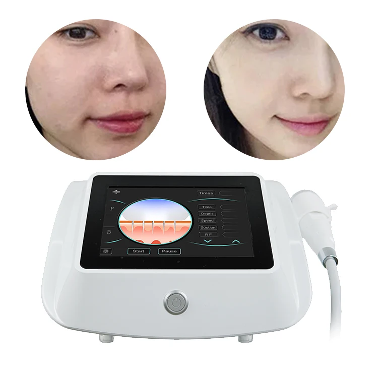 

Portable Radio Frequency Fractional Needle Microneedle Rf Microneedling Anti-wrinkle Machine Stretch Marks Removal