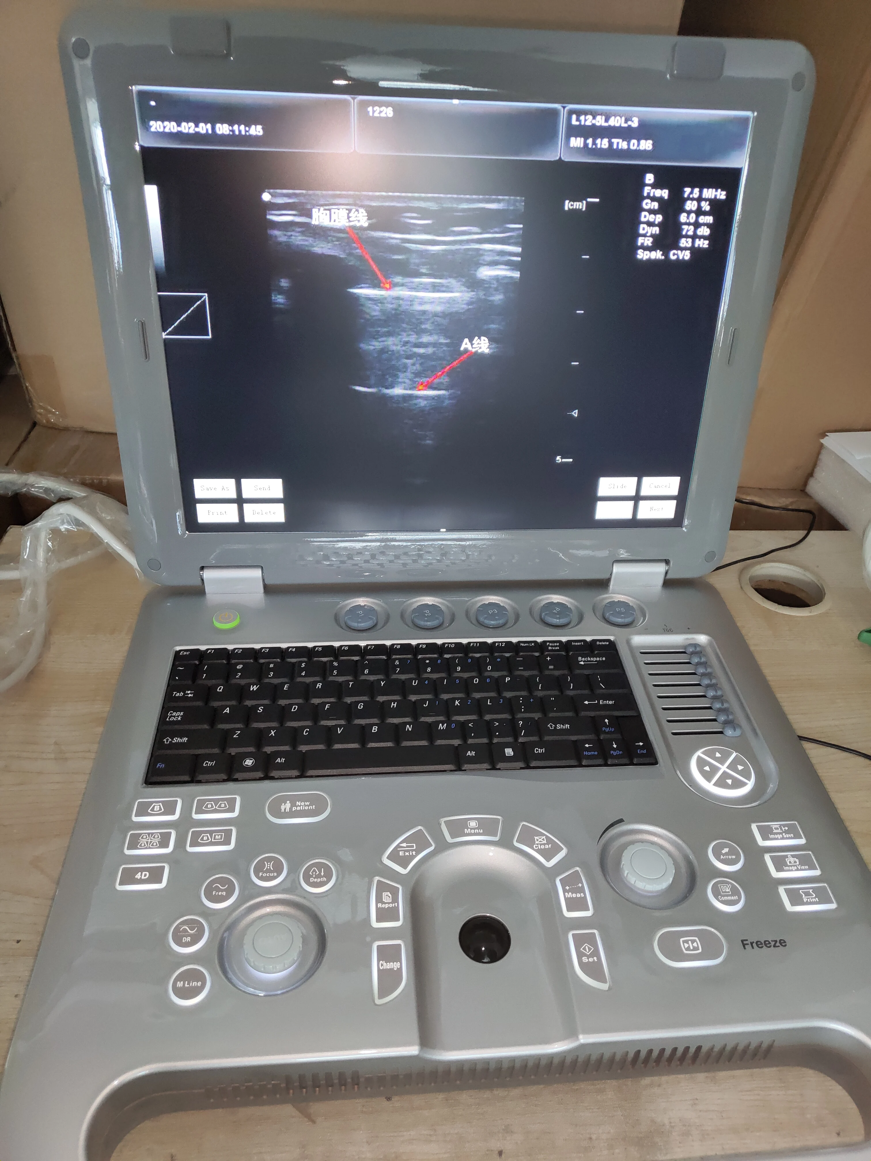 
China made factory price 2D/3D sonoscape S8 portable ultrasound machine SUN-800D 
