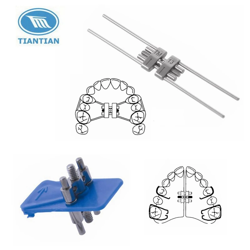 Dental Orthodontic Expansion Hyrax Screw Orthodontic Attachments Made