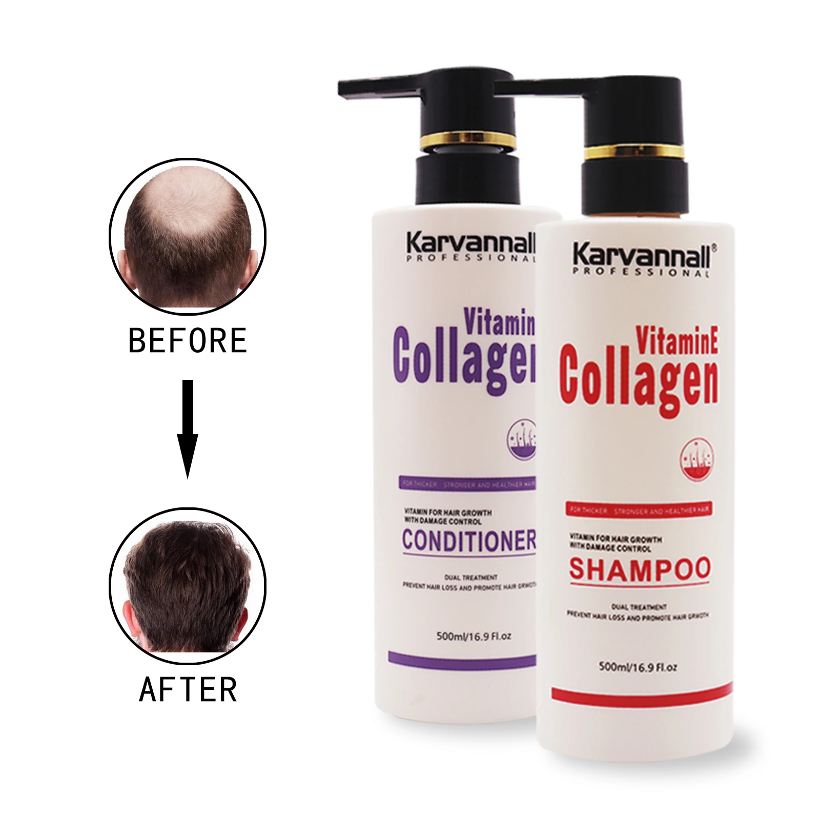 

hair care set private label hair growth oil Collagen Vitamin E Repair Hair Shampoo and conditioner set