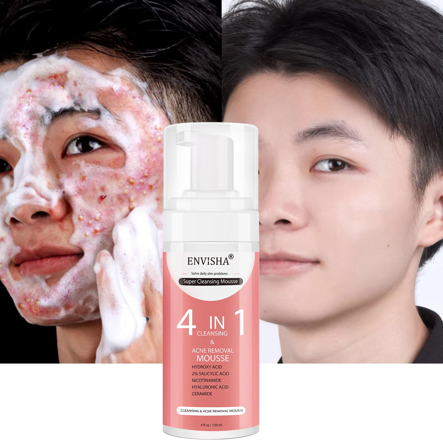 

Private Label Men Women Moisturizing Foaming Cleanser Deep Cleansing Anti Acne Brightening Whitening Vitamin C Face Wash